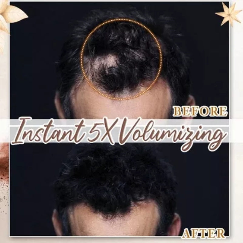 ✨Koop 1 krijg 1 gratis🙆‍♀️Hairline Powder camoufleert onmiddellijk haaruitval, Root Touch Up Hair Powder