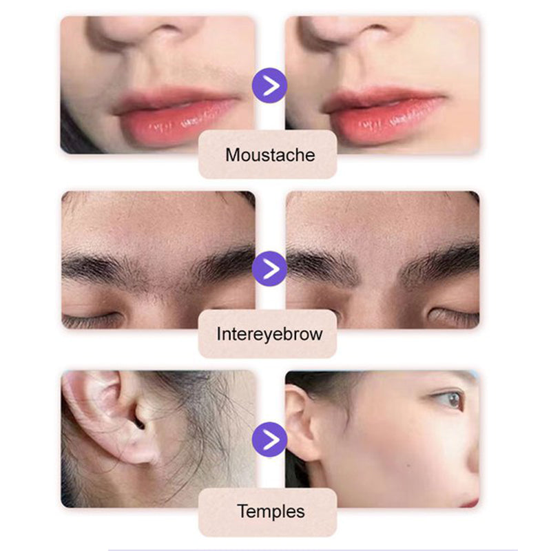 🔥Zachte en pijnloze crème voor het verwijderen van gezichtshaar