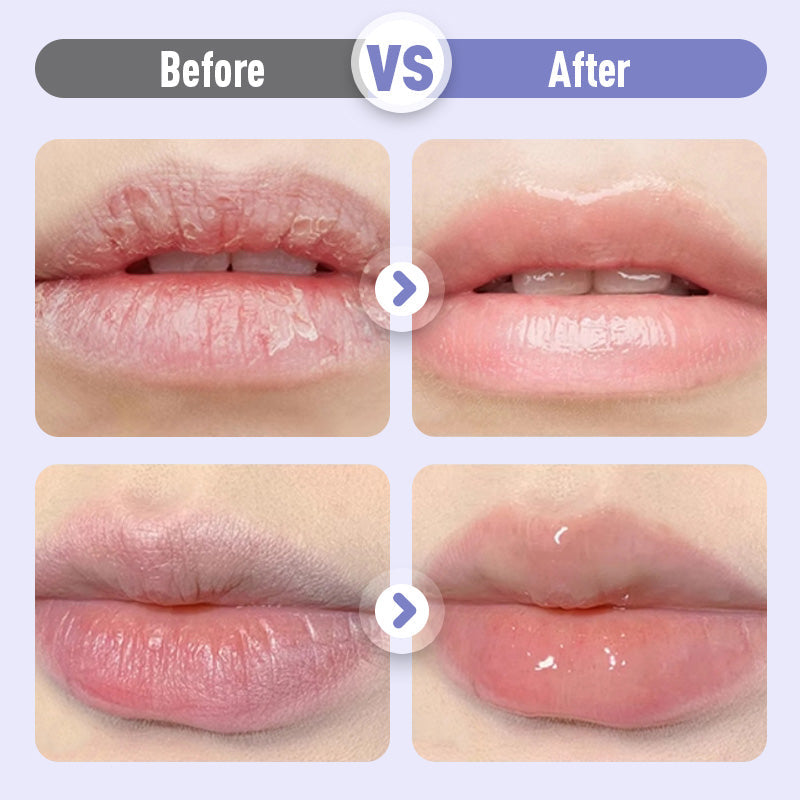 🔥Koop 1 krijg 1 gratis🔥Opvullend en Anti-Rimpel Hydraterend Lippenserum