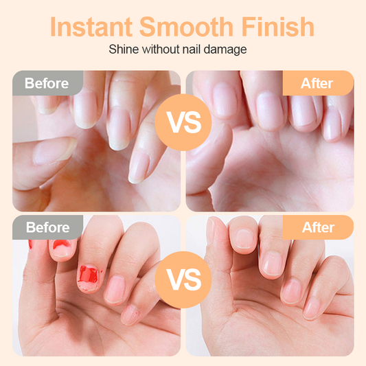 ✂️ TIJDELIJK 50% KORTING! 💅 2-in-1 Slimme Elektrische Nagelknipper & Nagelpolijster 🌟