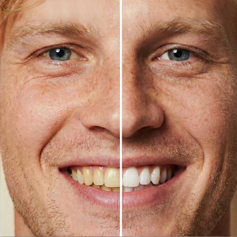 🏆2026 Nieuwe artikelen - 50% korting!🧴Instant Whitening Tooth Paint