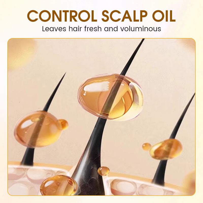 🥳2026 HETE KOOP🥳💞50K+ VERKOCHT!🌱🌿 De kracht van de natuur voor dikker haar. Zachte kruidenanti-verliesshampoo – 50% KORTING!✨🔁